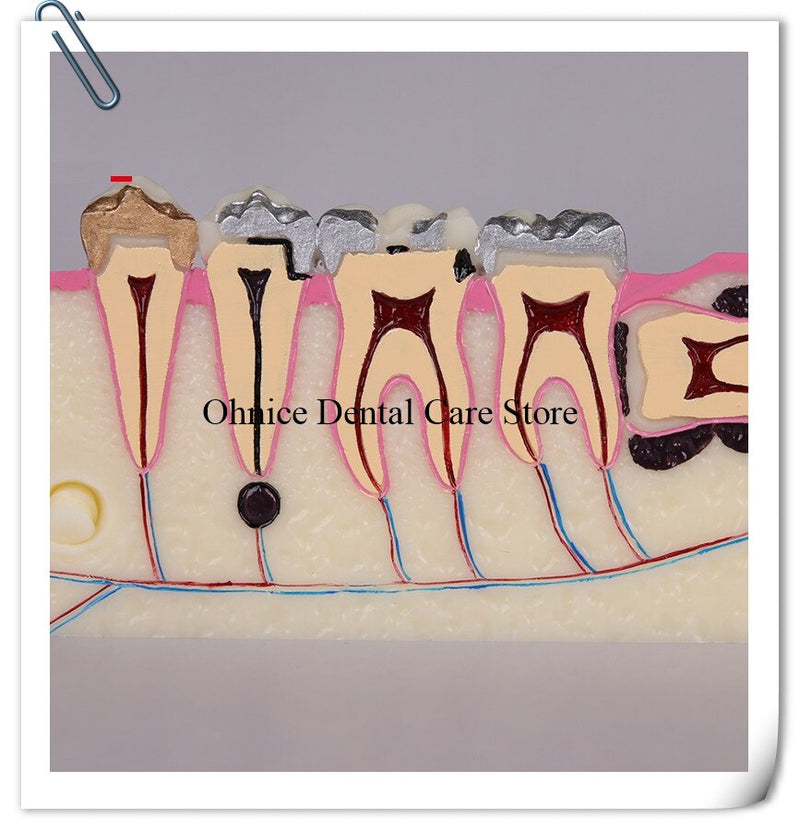 dental lab tooth model molar cross section study teeth model